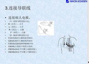 心电图机的操作流程视频,从启动到结束的全方位指导