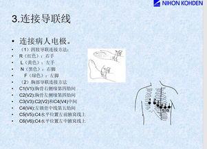 心电图机的操作流程视频,从启动到结束的全方位指导
